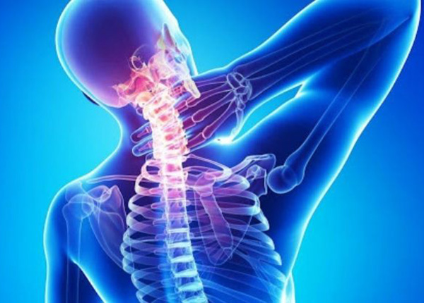 Gai cột sống chèn ép dây thần kinh có thể gây đau thắt lưng