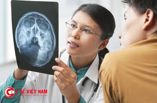 X quang xương sọ mặt được xem là hình ảnh định hướng cho các kỹ thuật Cắt lớp hiện đại