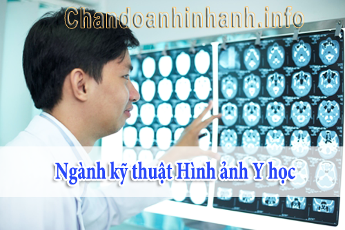 Tiềm năng ngành Kỹ thuật hình ảnh phát triển trong tương lai